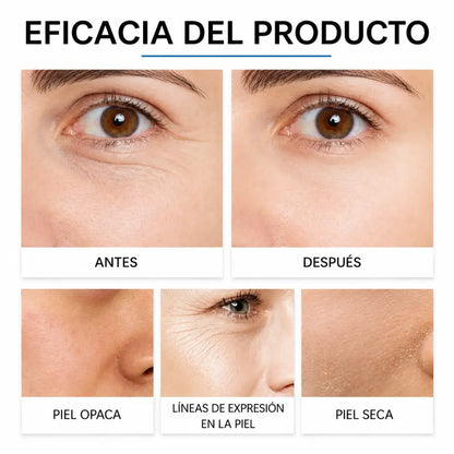 Crema Reafirmante Hoygi Premium